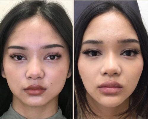 Bí quyết thanh thoát gương mặt của phụ nữ Nhật Bản