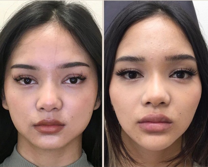 Bí quyết thanh thoát gương mặt của phụ nữ Nhật Bản