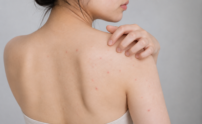 Da thường xuyên bị ngứa ngáy